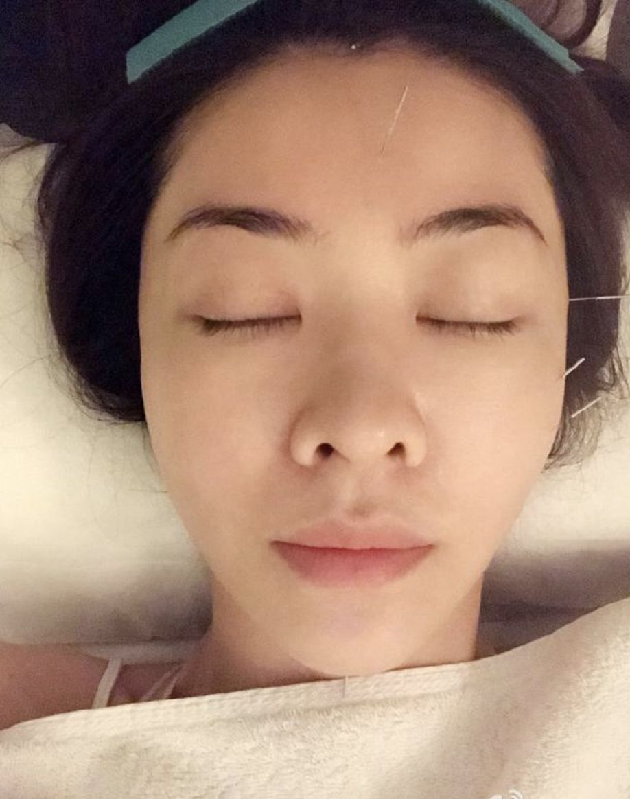 吳昕狂吞10種美白保健品吃出肝損傷？女星的養生大法是有多瘋狂？ 時尚 第41張