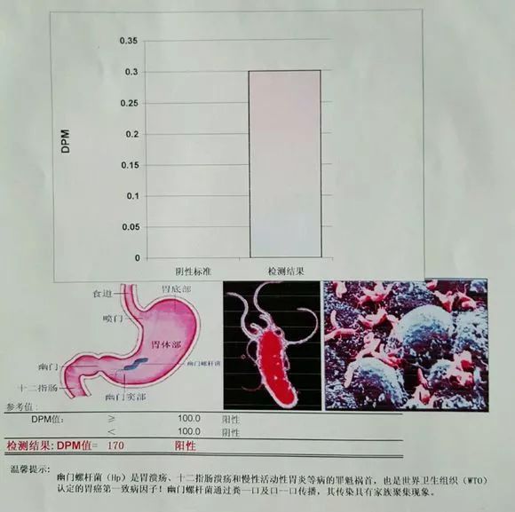 不知不觉又到了一年体检季了 看报告上「 幽门螺旋杆菌阳性」的诊断