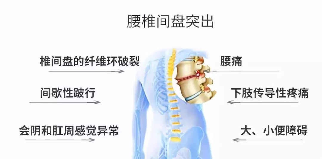 颈椎腰椎痛,肩椎痛,关节神经痛?一招儿帮你消除各种旧疾疼痛困扰!