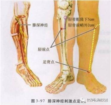 胫骨前嵴外约2cm处;踇长伸肌点:小腿前侧中线上,踝关节上方5-6cm处趾