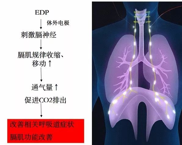 看!如何让你的膈肌起舞