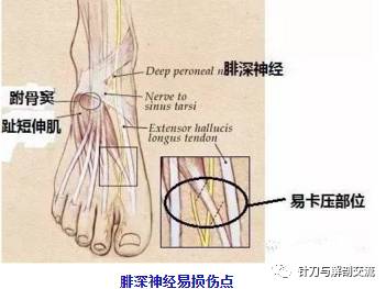 在胫骨前肌和趾长伸肌间,后在胫骨前肌与拇长伸肌之间下行至足背.