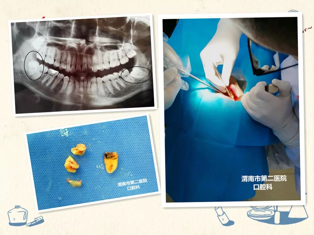 专家来袭秦瑞峰教授来渭南市第二医院口腔科啦