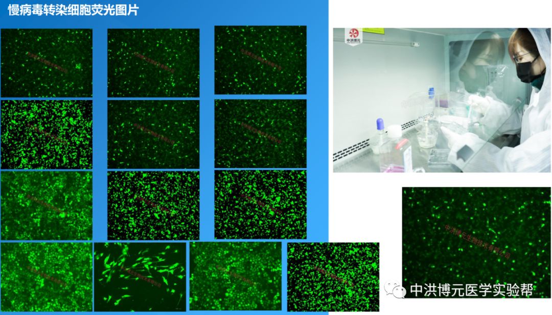 甲苯胺蓝染色番红o固绿染色masson染色he染色giemsa染色病理篇本次