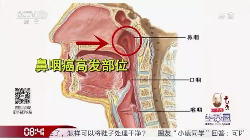 鼻咽癌的发病率为