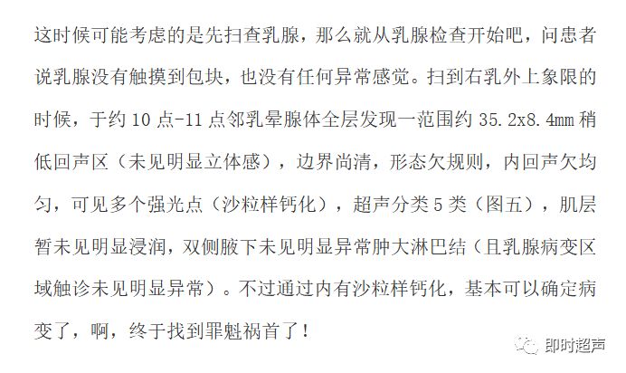 顺藤摸瓜寻找罪魁祸首右侧乳腺高级别导管癌