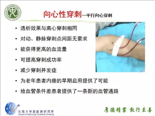 动静脉内瘘如何实施穿刺视频和ppt保你学会