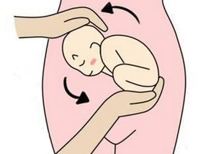 胎儿臀位该如何选择分娩方式?一定要剖腹产吗?