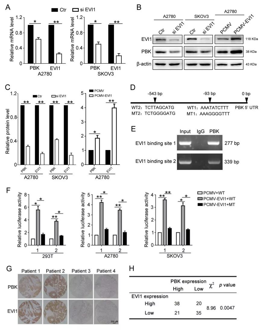 高级别浆液性卵巢癌:PDZ连接激酶促进