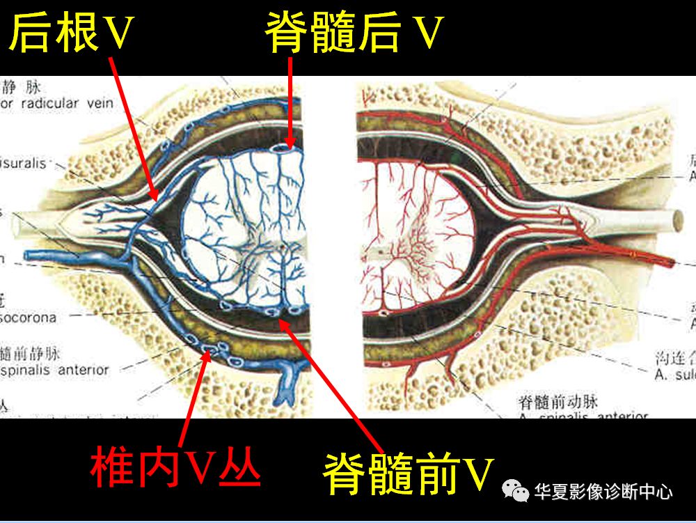 椎管内病变的精确定位