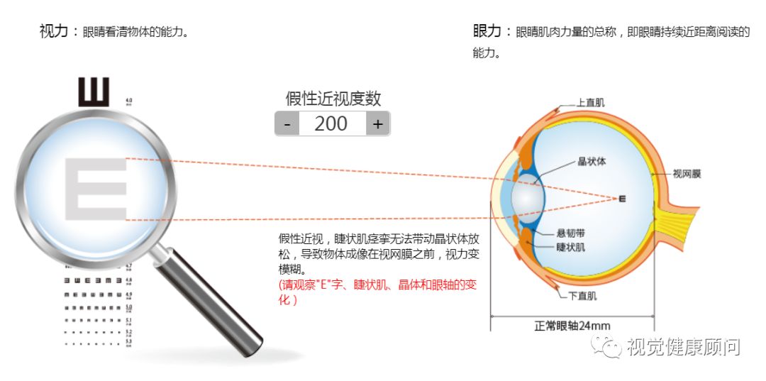 科普:假性近视50度-200度看物体眼睛的变化