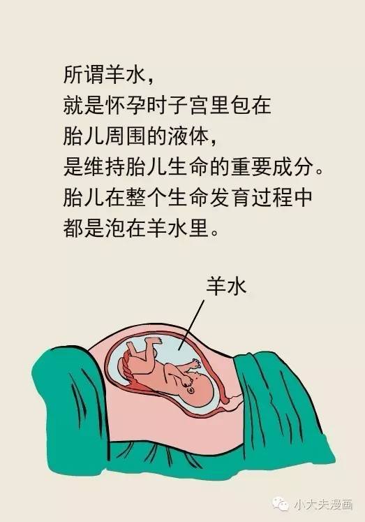 科普夺命的羊水栓塞是怎么回事