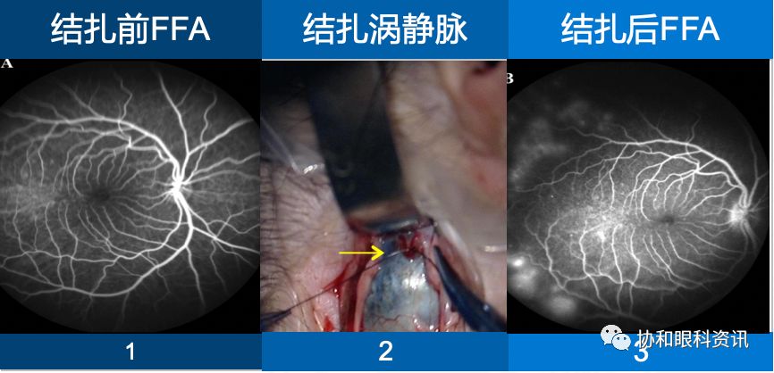 重磅!北京协和医院眼科获批中国医学科学院眼