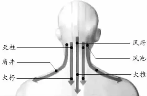 肩颈疼,刮5条线 具体方法是: 在颈后和肩膀均匀涂抹刮痧油,先刮拭第