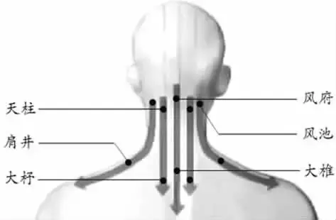 用刮痧板沿颈后5条线刮拭能起到很好的治疗作用.