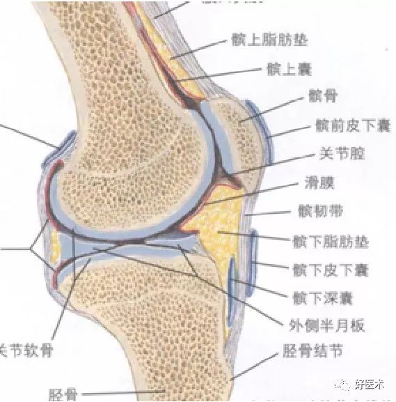 十分钟系统掌握:膝关节滑膜炎的分类及治疗!