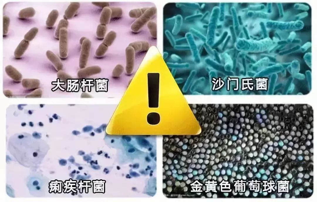 内衣有虫卵_阴虱虫卵图片