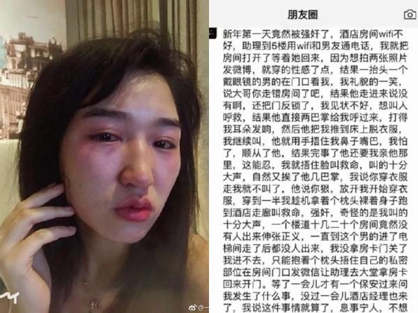 女演员自曝被性暴力挺好玩,网友:没底线了_沈樵