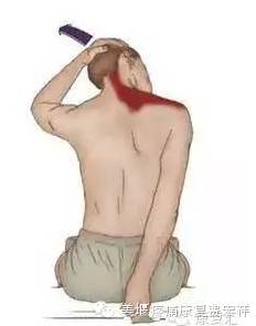 肩颈痛怎么办