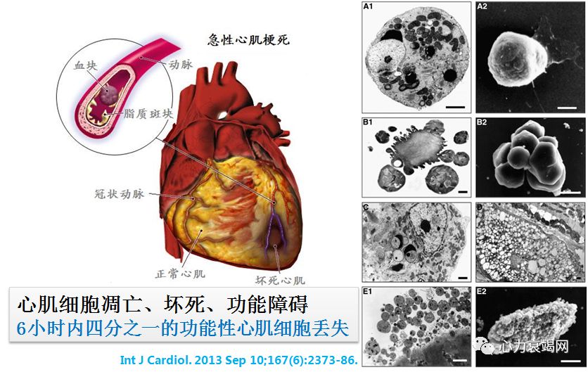 聂宇教授:急性炎症在心肌再生中的作用与机制