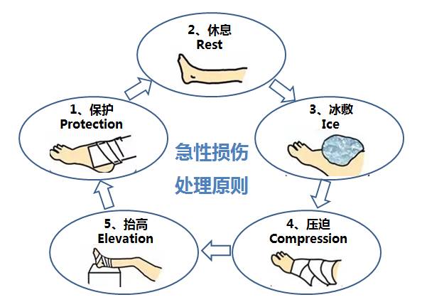 安全知识肌肉拉伤的处理方法