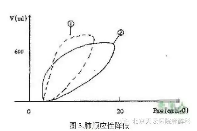 目前气腹主要选用二氧化碳气,体位依据不同的手术部位采取不同的体位