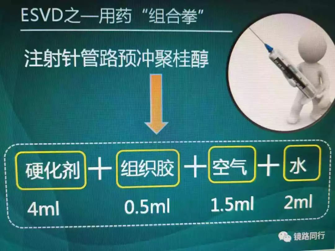 组织胶注射治疗的操作要点:在胃内用注射针"探"查所见血管,即探其空虚