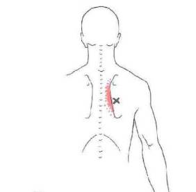 肩胛骨内侧缘疼痛的治疗
