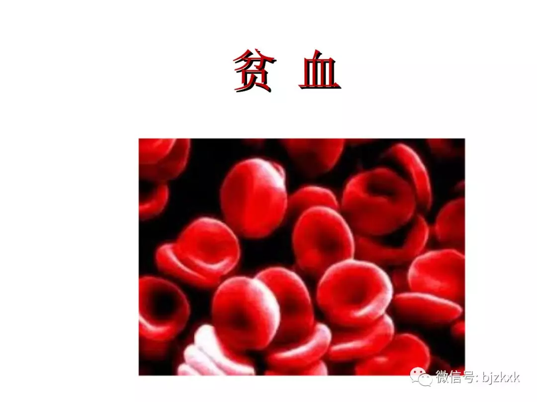 血液病教授史淑荣科普再生障碍性贫血到底有多严重会不会危及生命健康