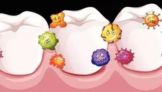 导致牙周病的罪魁祸首就是牙菌斑和口腔细菌