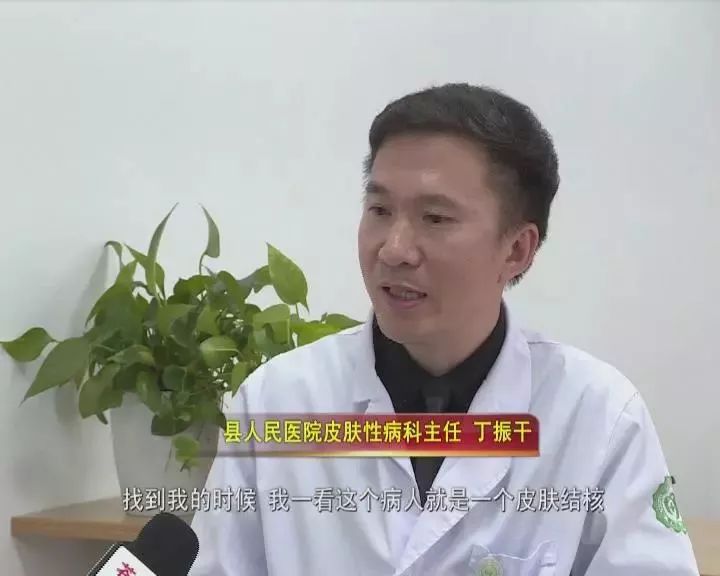 县人民医院皮肤性病科主任 丁振干"教授跟他讲要不你来苍南找丁振干