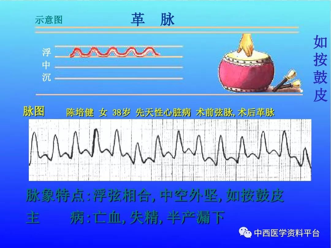 最全的入门脉诊知识让你快速掌握脉诊附详细图解