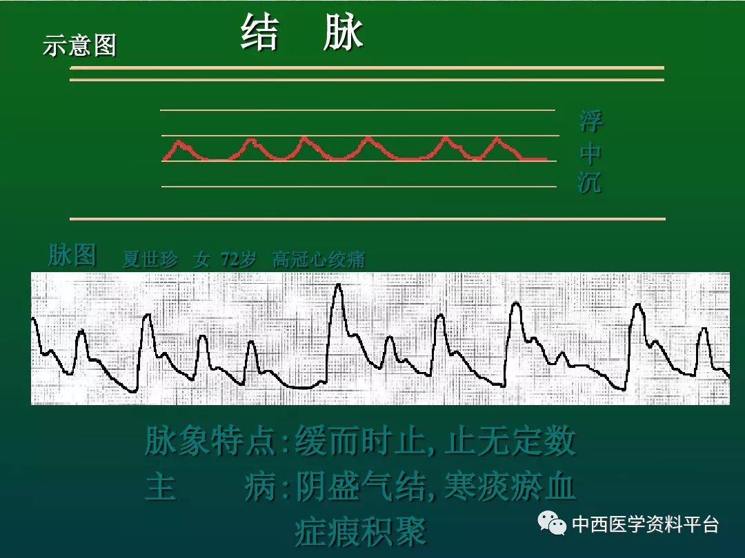 最全的入门脉诊知识让你快速掌握脉诊附详细图解