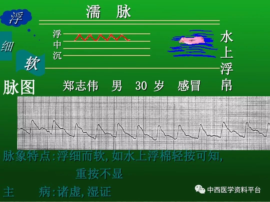 最全的入门脉诊知识让你快速掌握脉诊附详细图解