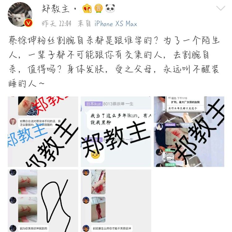 蔡徐坤粉丝太疯狂接二连三为其割腕网友ikun着魔了