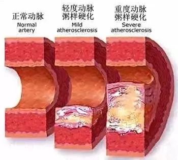 经常手脚发麻怎么办