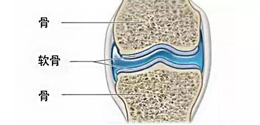 所以说,软骨其实就是关节的"保护伞".正常关节