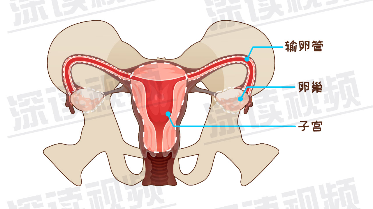 受精卵缘何子宫外安家?是输卵管不通?还是炎症,肿瘤在