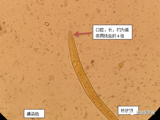 我是这么培养钩虫的……_虫卵