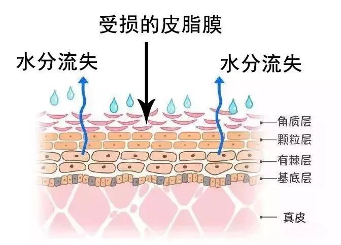 皮肤抗衰专家告诉我们 所有存在皮肤问题的人,皮脂膜都存在不同程度