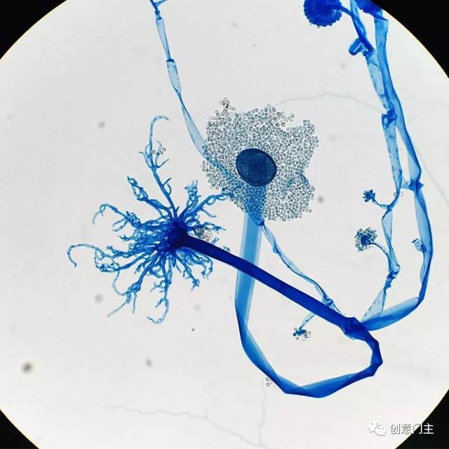 这种真菌在显微镜下看起来像是一种美丽的蓝色的花朵.