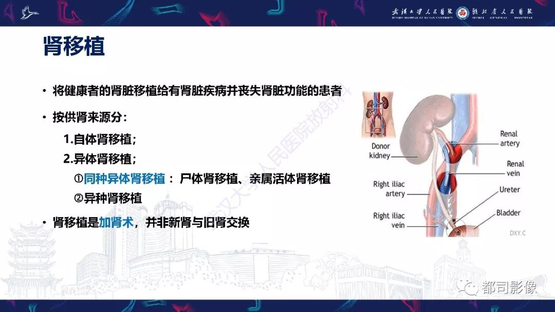 肾移植术后并发症的ct和mri表现