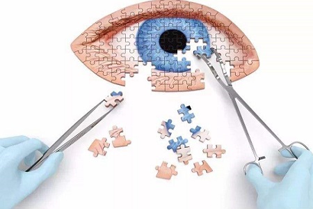 首大施玉英白内障手术并不能一劳永逸日常预防不能大意