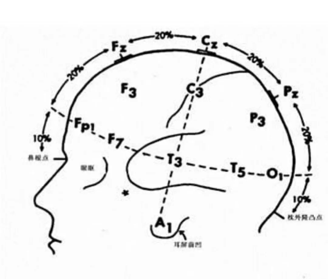 留言解读——【经颅磁刺激】