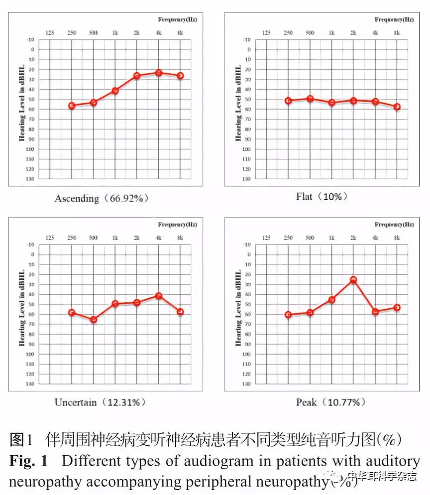 纯音测听无法配合):纯音听力图表现为上升型87耳,占66