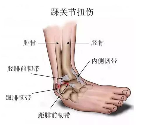 踝关节在跖屈时,也就是我们做踮脚这个动作时,往往脚会向内翻,即脚心