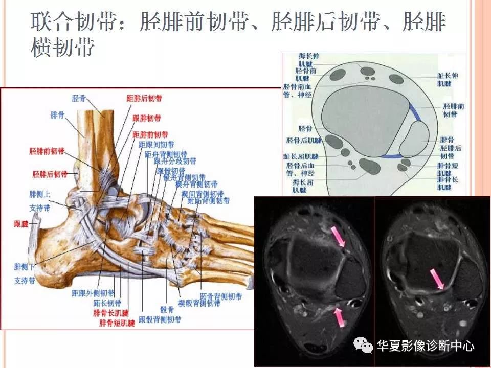 踝关节mri解剖及常见损伤类型