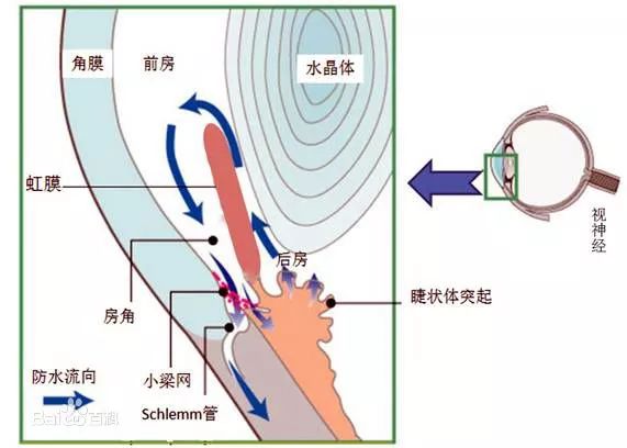 青光眼偷视力的窃贼