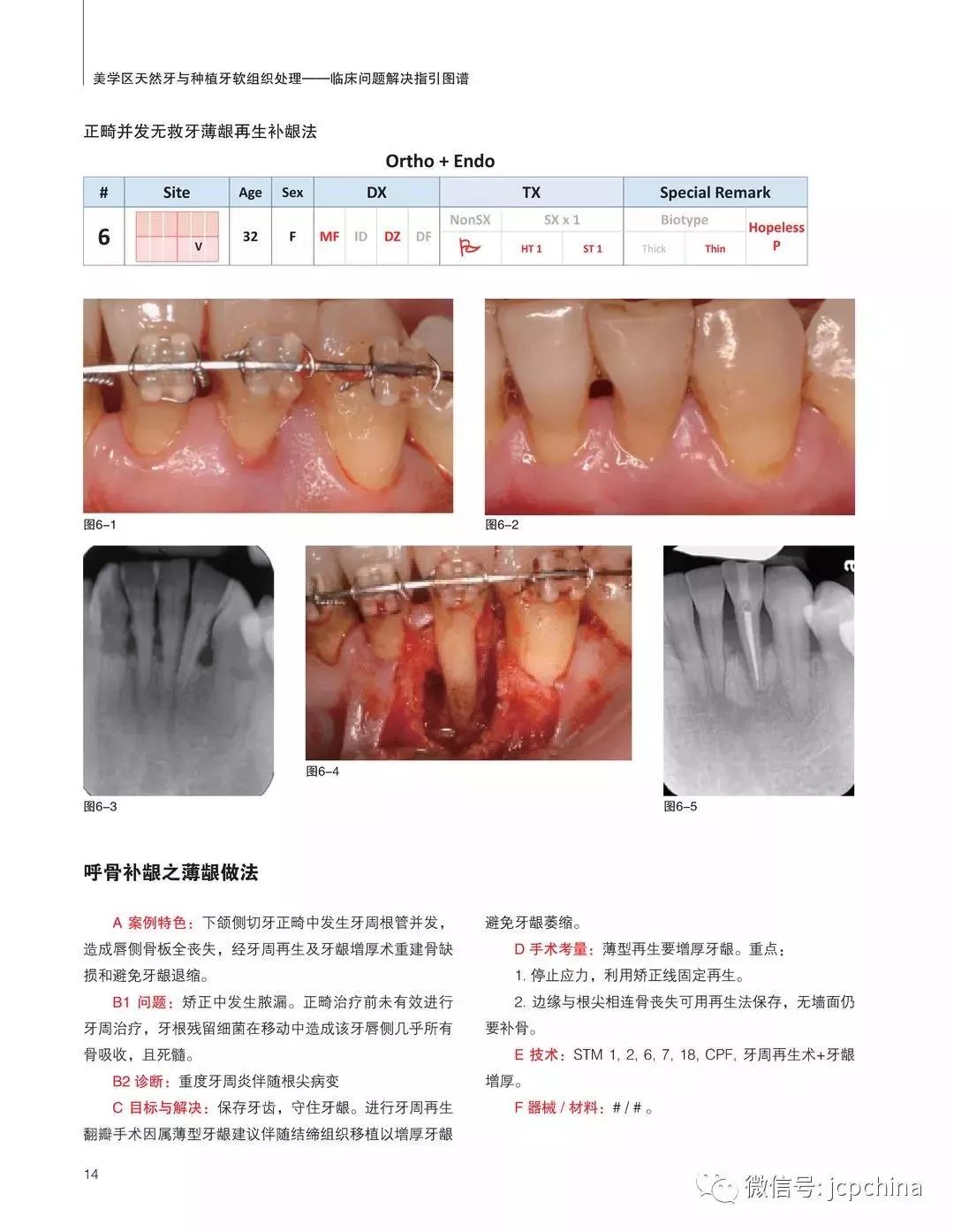 国立台湾大学 牙周病科兼任主治医师 gide国际牙科教育学院教授 博世