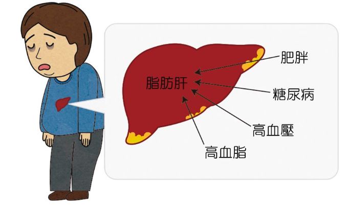 痛风,糖尿病,脂肪肝…为什么开始招惹年轻人?